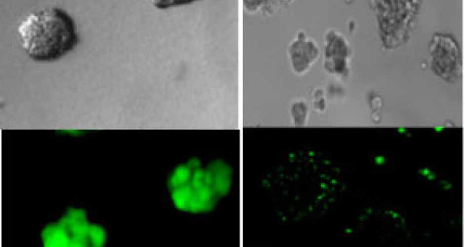 bacteria kill cancer